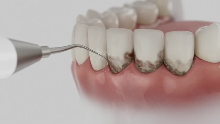 Reliable Teeth Whitening contractor in Warren, AR by Smile Center Dentistry